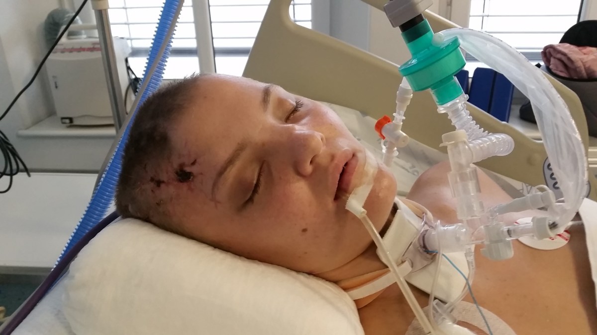 Budzimy Patrycję! Wspieramy aktywnie jej&nbsp;rehabilitację